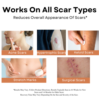 Advanced Scar Gel